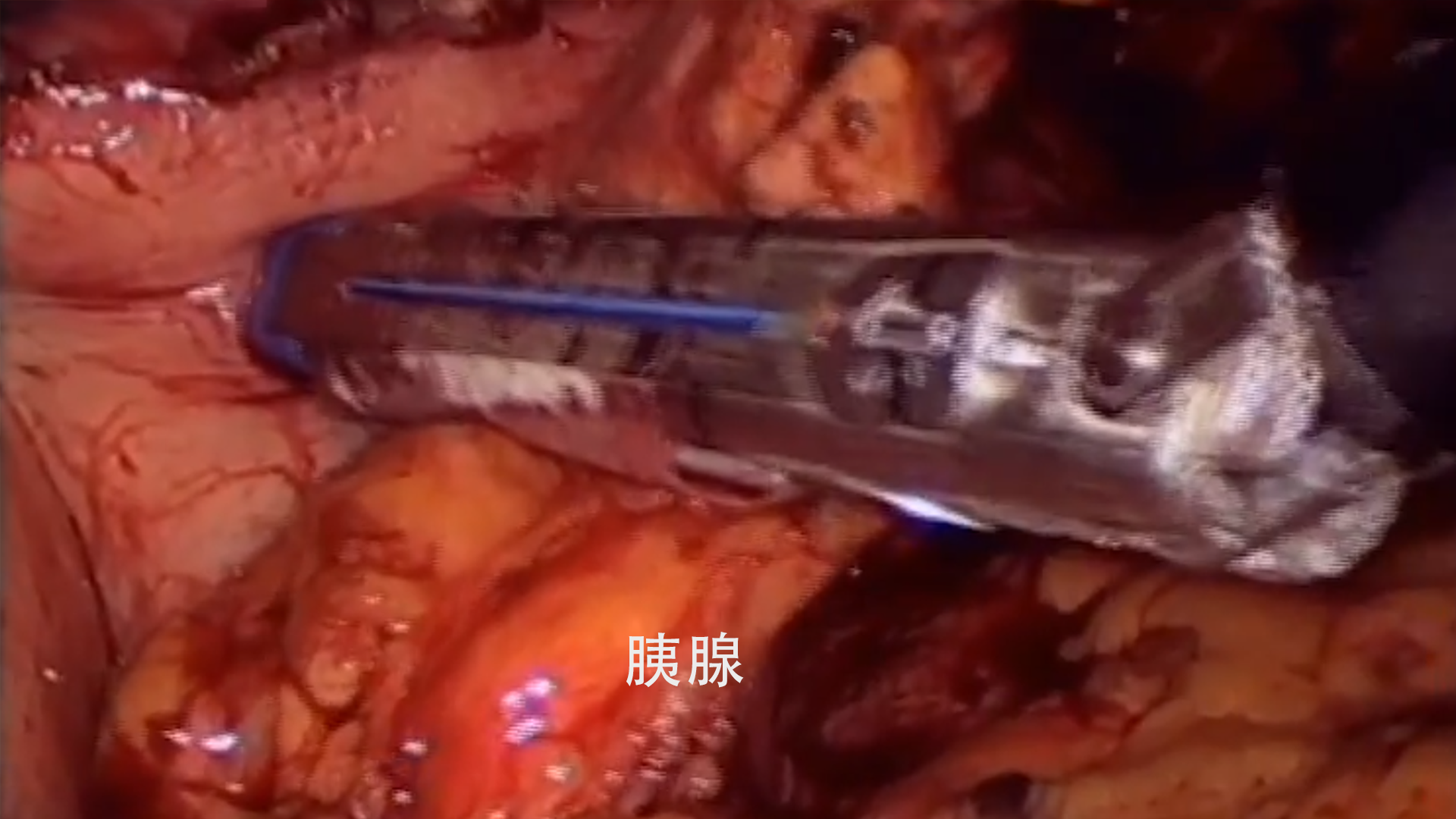 yixian.png yixian.png